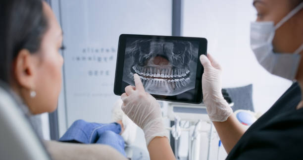 Licensed Tooth Extraction service in Farmington, UT - Smile Center Dentistry